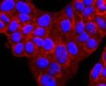 alpha-1 Antitrypsin Antibody in Immunocytochemistry (ICC/IF)