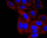 alpha-1 Antitrypsin Antibody in Immunocytochemistry (ICC/IF)