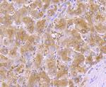 alpha-1 Antitrypsin Antibody in Immunohistochemistry (Paraffin) (IHC (P))