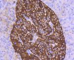 Chromogranin A Antibody in Immunohistochemistry (Paraffin) (IHC (P))