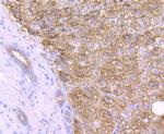 Catalase Antibody in Immunohistochemistry (Paraffin) (IHC (P))