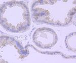 Catalase Antibody in Immunohistochemistry (Paraffin) (IHC (P))