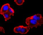 FMRP Antibody in Immunocytochemistry (ICC/IF)