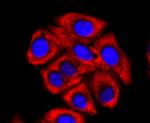 FMRP Antibody in Immunocytochemistry (ICC/IF)