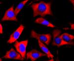 FMRP Antibody in Immunocytochemistry (ICC/IF)