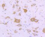 FMRP Antibody in Immunohistochemistry (Paraffin) (IHC (P))