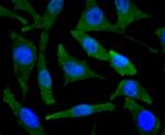 BNIP3 Antibody in Immunocytochemistry (ICC/IF)