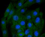 BNIP3 Antibody in Immunocytochemistry (ICC/IF)