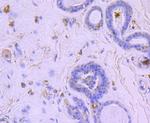 BNIP3 Antibody in Immunohistochemistry (Paraffin) (IHC (P))