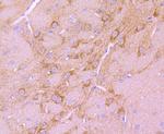 BNIP3 Antibody in Immunohistochemistry (Paraffin) (IHC (P))