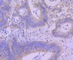 BNIP3 Antibody in Immunohistochemistry (Paraffin) (IHC (P))