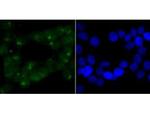 CHD4 Antibody in Immunocytochemistry (ICC/IF)