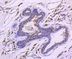 CHD4 Antibody in Immunohistochemistry (Paraffin) (IHC (P))