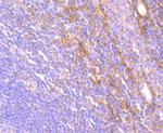 JAK3 Antibody in Immunohistochemistry (Paraffin) (IHC (P))