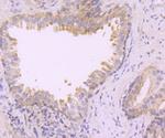 TAK1 Antibody in Immunohistochemistry (Paraffin) (IHC (P))