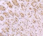 TAK1 Antibody in Immunohistochemistry (Paraffin) (IHC (P))