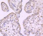 TAK1 Antibody in Immunohistochemistry (Paraffin) (IHC (P))