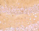 Aldolase A Antibody in Immunohistochemistry (Paraffin) (IHC (P))