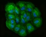 LOXL2 Antibody in Immunocytochemistry (ICC/IF)