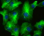 LOXL2 Antibody in Immunocytochemistry (ICC/IF)