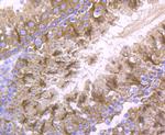 LOXL2 Antibody in Immunohistochemistry (Paraffin) (IHC (P))