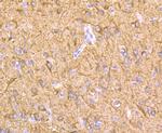 LOXL2 Antibody in Immunohistochemistry (Paraffin) (IHC (P))