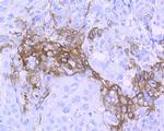 WNT5A Antibody in Immunohistochemistry (Paraffin) (IHC (P))