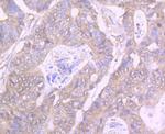 GIT1 Antibody in Immunohistochemistry (Paraffin) (IHC (P))