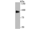 GIT1 Antibody in Western Blot (WB)