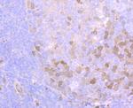 Securin Antibody in Immunohistochemistry (Paraffin) (IHC (P))