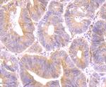 Securin Antibody in Immunohistochemistry (Paraffin) (IHC (P))