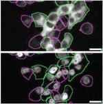 Huntingtin Antibody in Immunocytochemistry (ICC/IF)