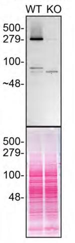 Huntingtin Antibody in Western Blot (WB)