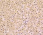 PAK2 Antibody in Immunohistochemistry (Paraffin) (IHC (P))