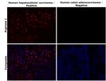 Arginase 1 Antibody in Immunohistochemistry (Paraffin) (IHC (P))