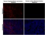 Arginase 1 Antibody in Immunohistochemistry (Paraffin) (IHC (P))