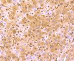 Arginase 1 Antibody in Immunohistochemistry (Paraffin) (IHC (P))