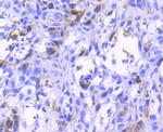 Phospho-CDK2 (Tyr15) Antibody in Immunohistochemistry (Paraffin) (IHC (P))