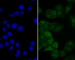 eIF4A3 Antibody in Immunocytochemistry (ICC/IF)