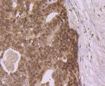 eIF4A3 Antibody in Immunohistochemistry (Paraffin) (IHC (P))