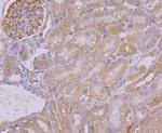 PUM1 Antibody in Immunohistochemistry (Paraffin) (IHC (P))