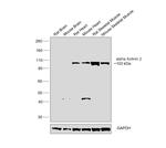 alpha Actinin 2 Antibody in Western Blot (WB)