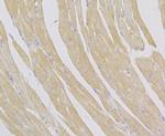 alpha Actinin 2 Antibody in Immunohistochemistry (Paraffin) (IHC (P))