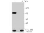 Phospho-BTK (Tyr223) Antibody in Western Blot (WB)