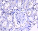 SHP2 Antibody in Immunohistochemistry (Paraffin) (IHC (P))