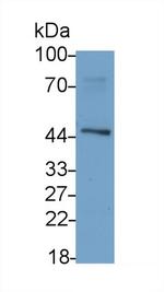 ACVR2A Antibody in Western Blot (WB)