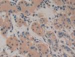 Amphiregulin Antibody in Immunohistochemistry (Paraffin) (IHC (P))