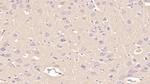 Annexin V Antibody in Immunohistochemistry (Paraffin) (IHC (P))