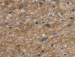 Aquaporin 4 Antibody in Immunohistochemistry (Paraffin) (IHC (P))