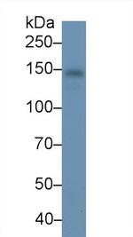 Ceruloplasmin Antibody in Western Blot (WB)